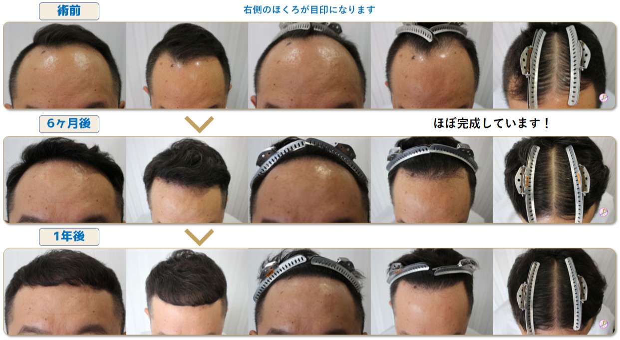 術前写真
