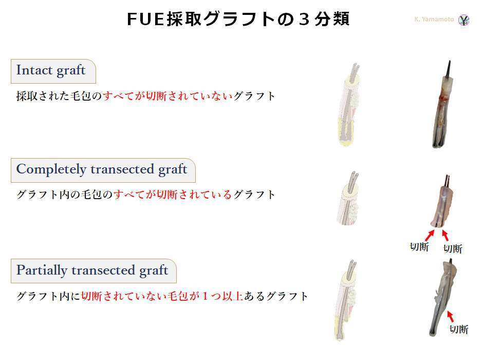 FUEにおける採取グラフトの分類