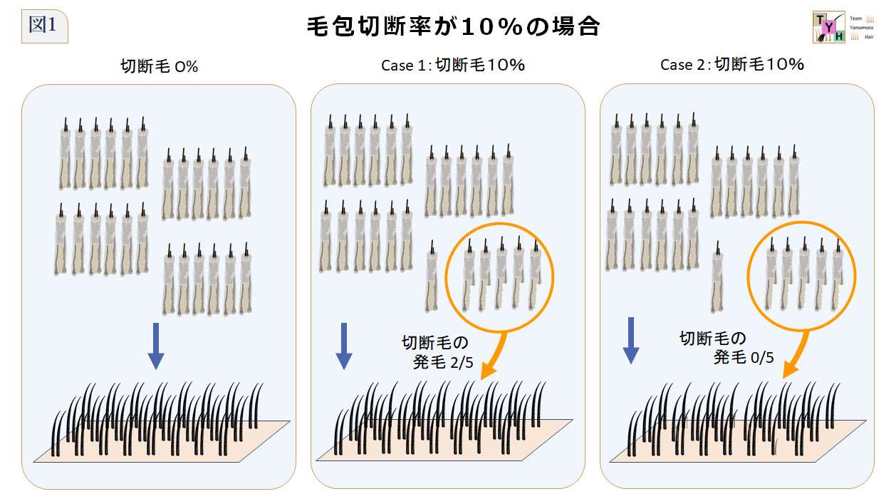 毛包切断率10%のケース