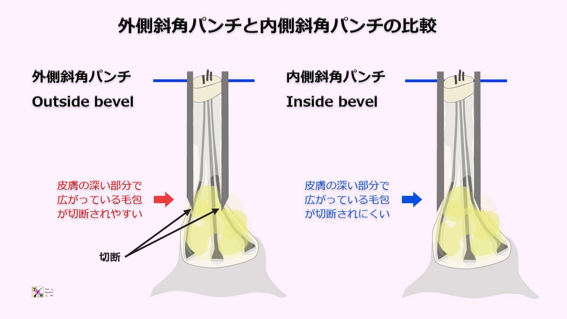 外側斜角パンチと内側斜角パンチの比較