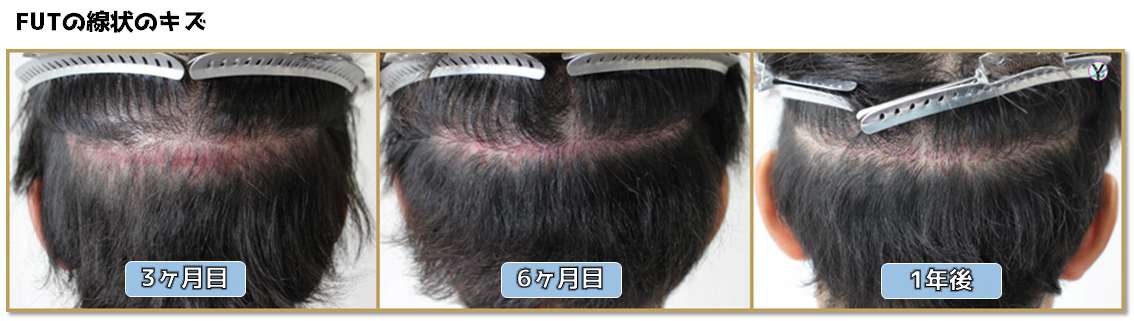 術後写真