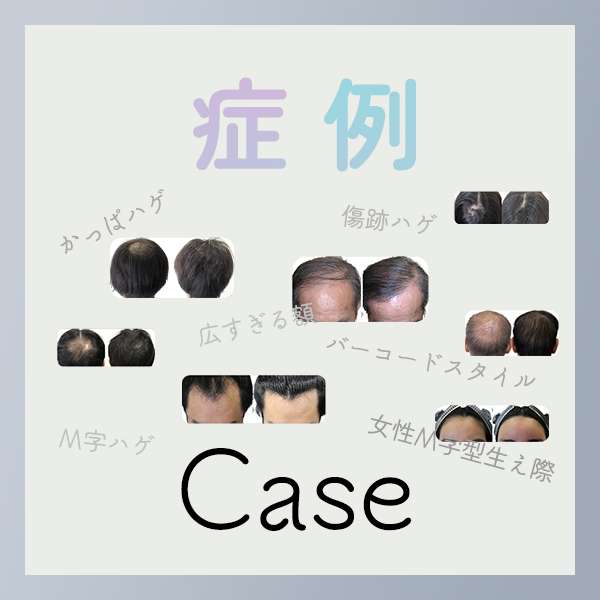 症例Case
