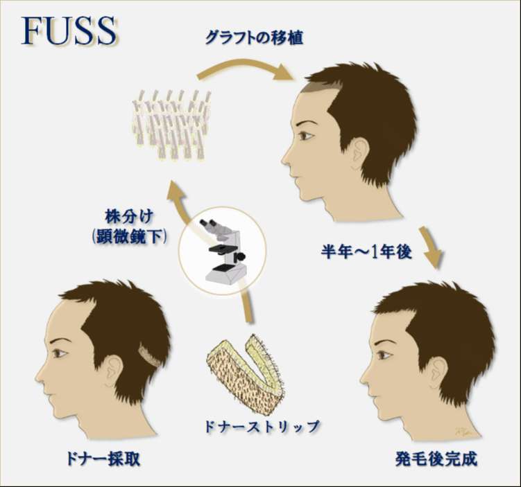 strip FUT